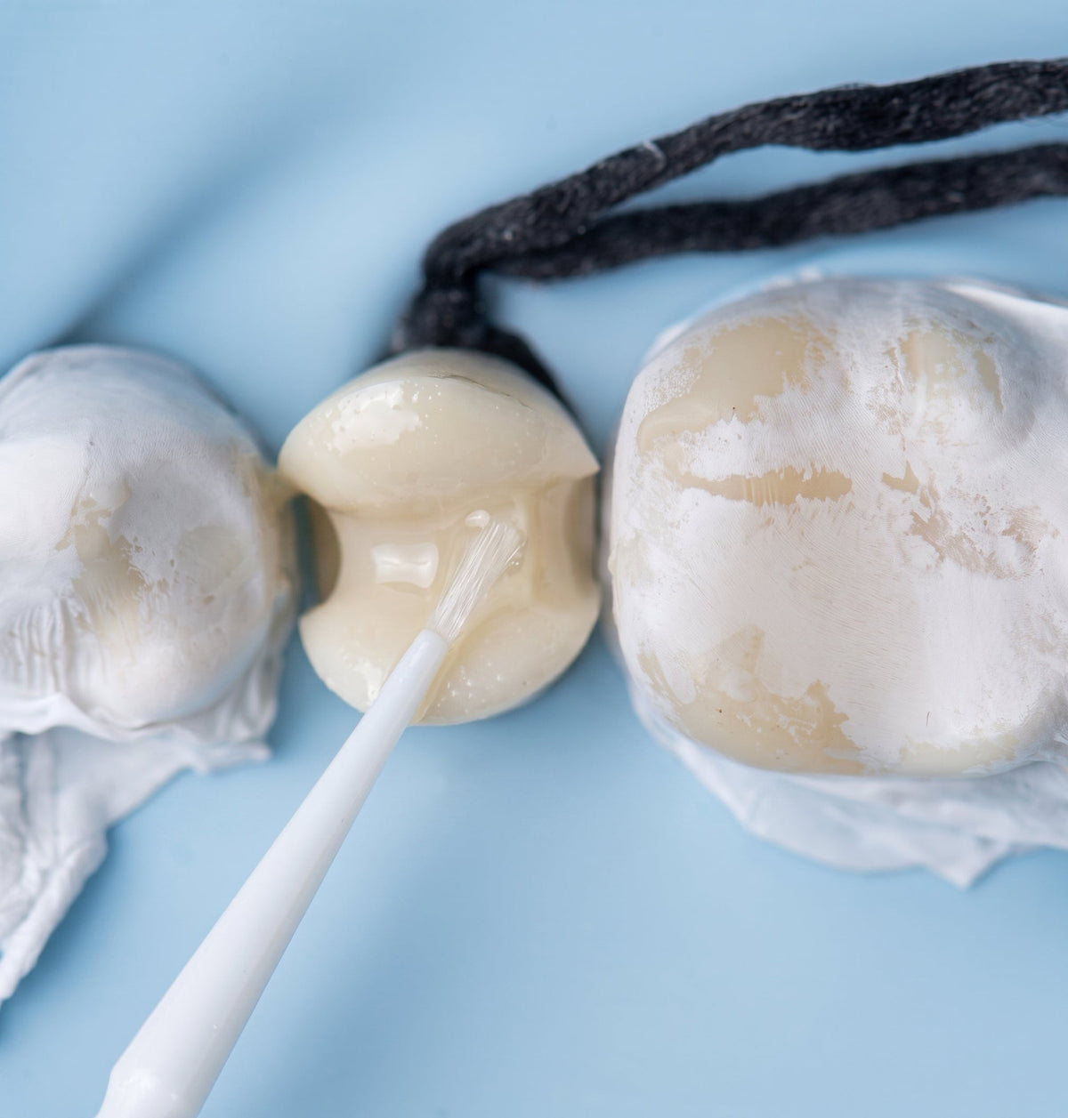 The Complete Bonded Restoration Protocol: Cementing Ceramic Restorations Step by Step