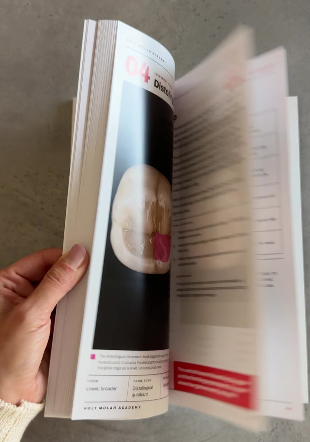 Posterior Composite Restorations - Layer by Layer. Printed Book.