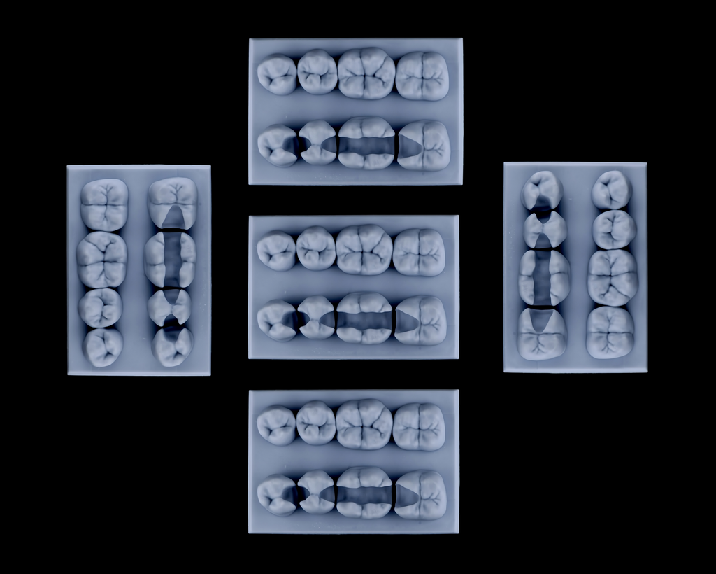 Class II - Mandibular Posterior Model ( 5 pcs )