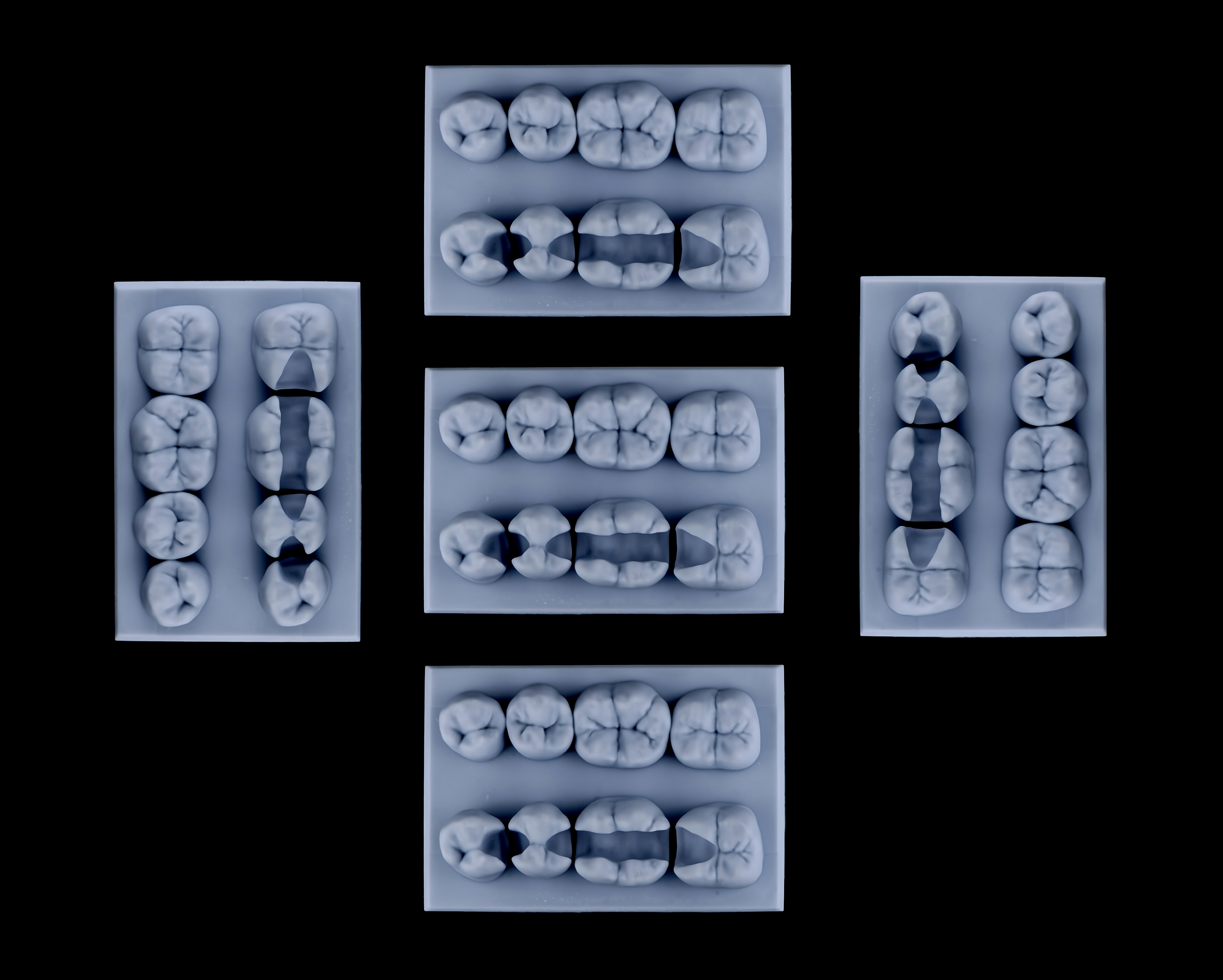 Class II - Mandibular Posterior Model ( 5 pcs )