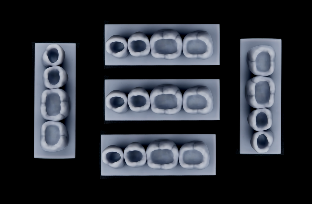 Class I – Mandibular Posterior Occlusal ( 5psc )